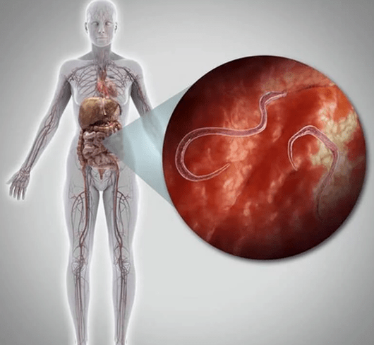 Parasites in the human body