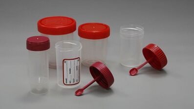 How to prepare for the parasite test