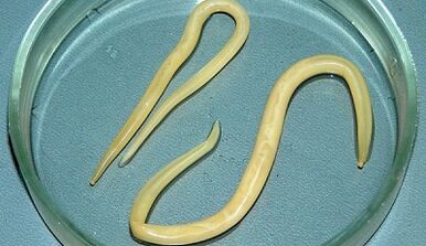 How to take ascariasis tests properly