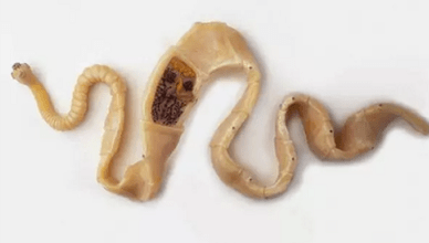 How to find the presence of parasites in the body